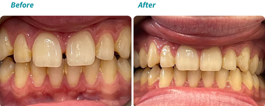 Patient before and after 1